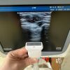 SONOSCAPE S20 Ultrasound 3probes Ultrasound Unit