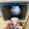 SONOSCAPE S20 Ultrasound 3probes Ultrasound Unit