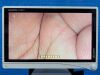 STRYKER 1588 Processor YOM: 2020 Laparoscope