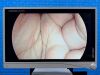 STRYKER 1488 Laparoscopy Processor YOM: 2017 Laparoscope