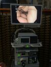 OLYMPUS CV 190 Endoscope