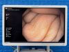 OLYMPUS Scope Model: GIF-H190N Gastroscope Gastroscope