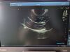TOSHIBA Aplio A Ultrasound System