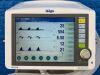 DRAEGER Savina 300 Ventilator with low working 768 Hours YOM: 2020 Ventilator