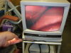AM ALL PRO MEDSCOPE Colposcope