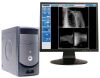 AMERICAN MEDICAL SALES C-1 (5.0) PACS/RIS