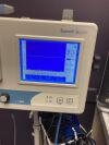 SUMMIT Vista-ABI Doppler Waveform Analyzer