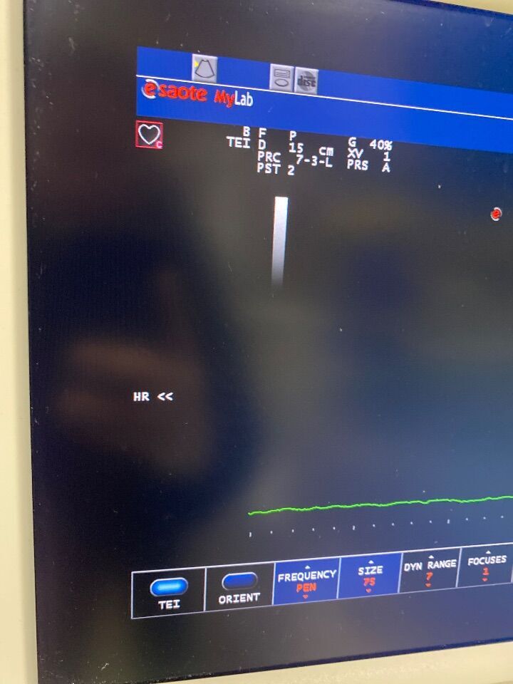 ESAOTE XVISION Ultrasound Machine