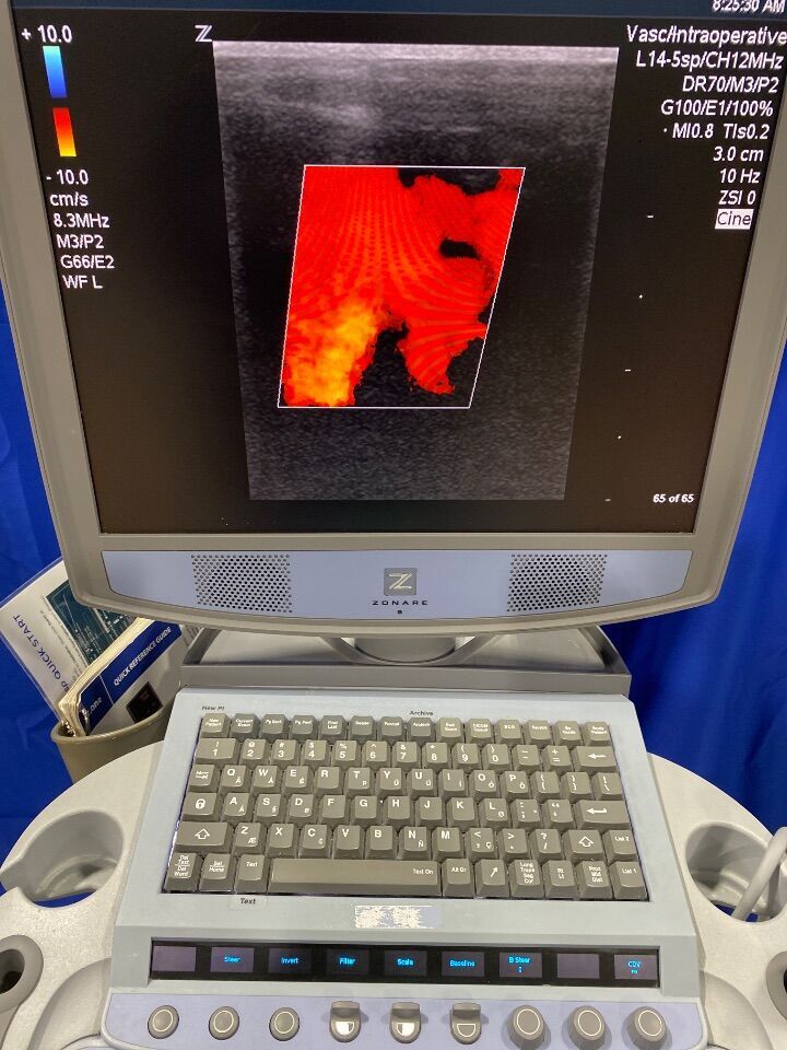 ZONARE Z.One Scan 82001M-20 Ultrasound Machine