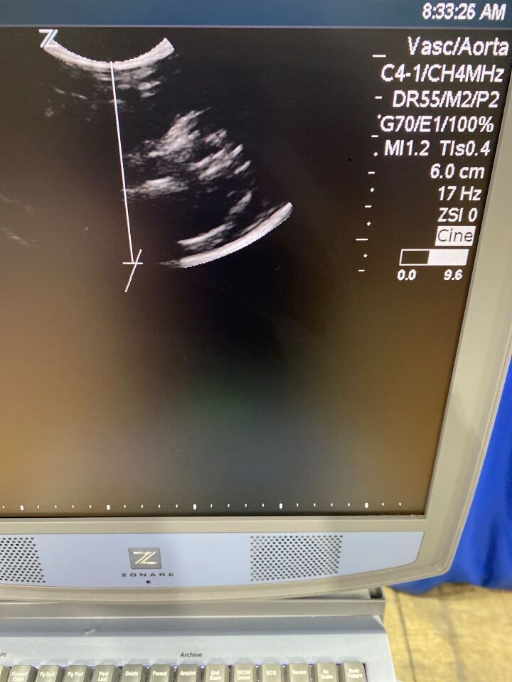 ZONARE C4-1 Ultrasound Transducer
