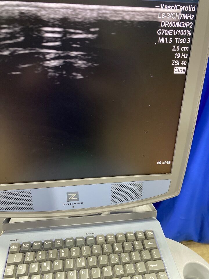 ZONARE L8-3 Ultrasound Transducer