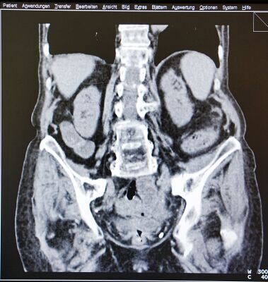 SIEMENS Sensation 40 CT Scanner