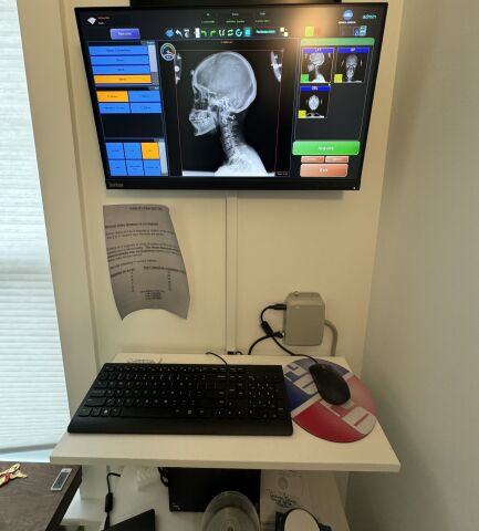 MAVEN Digital XRay Straight Arm XRay system Chiropractic X-ray