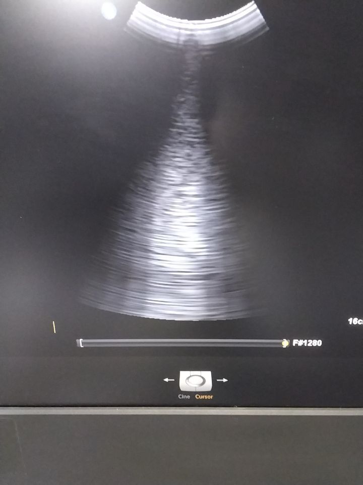PHILIPS Affiniti 70 Diagnostic Ultrasound System