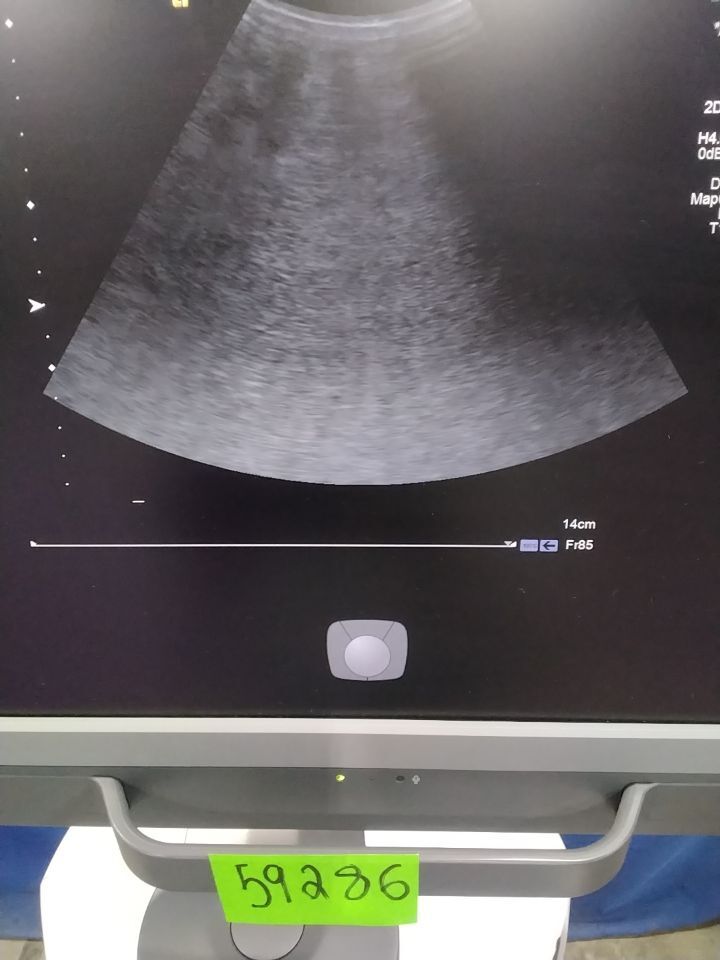SIEMENS ACUSON S1000 Diagnostic Ultrasound System