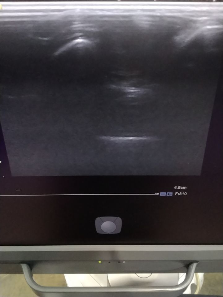 SIEMENS Acuson 18L6 HD Ultrasound Transducer