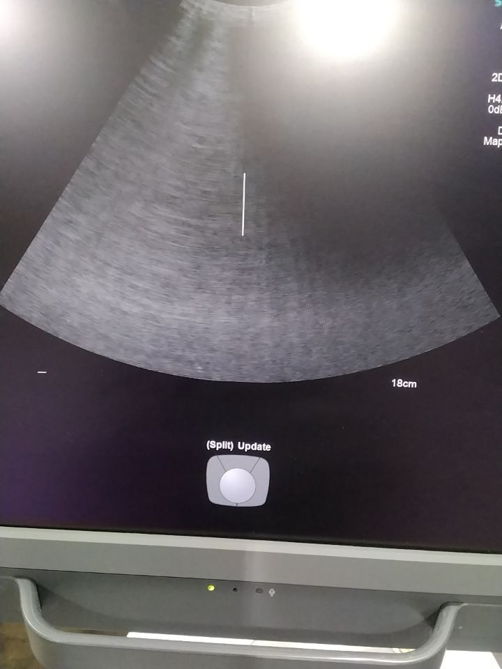 SIEMENS 4C1 Ultrasound Transducer