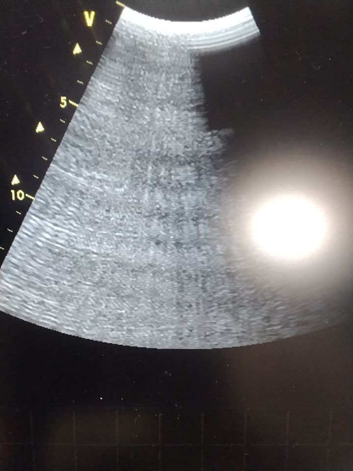 GE Vivid 7 Ultrasound machine