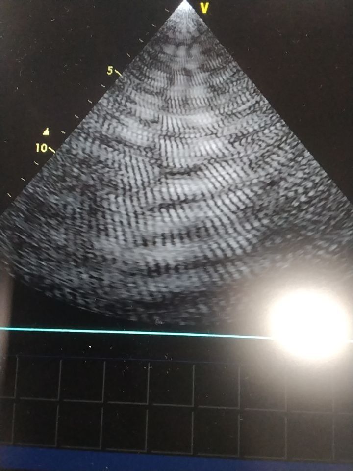 GE 3S Ultrasound Transducer