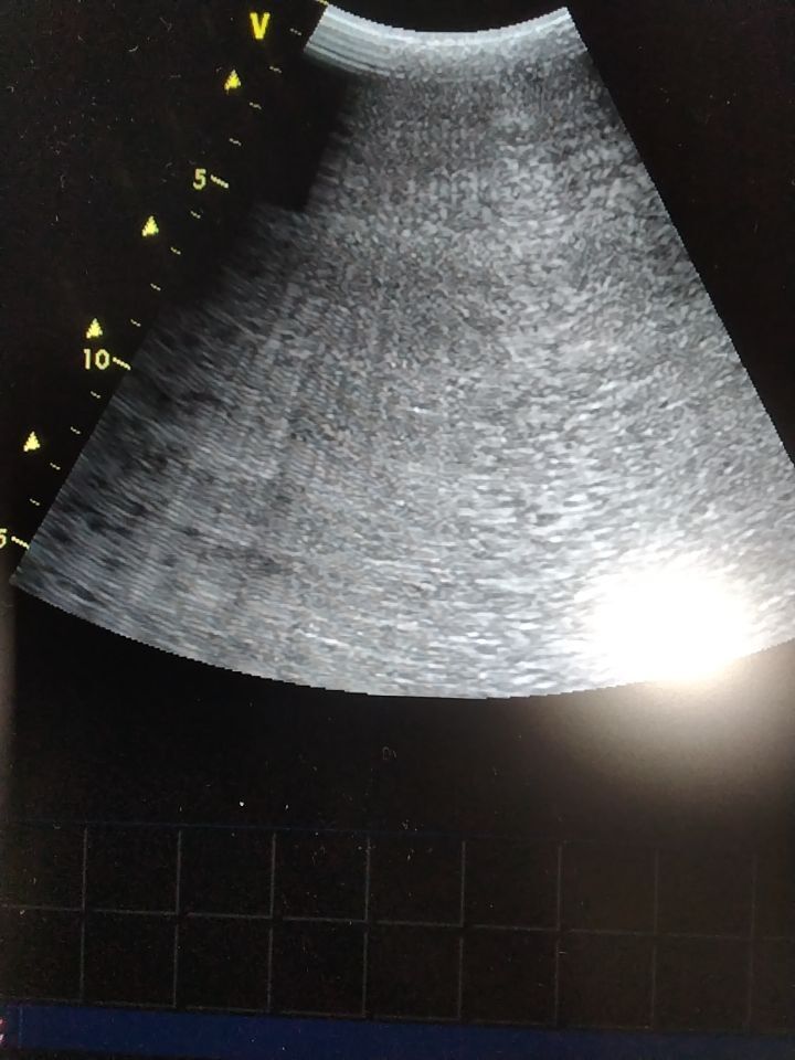 GE 4C Ultrasound Probe Ultrasound Transducer