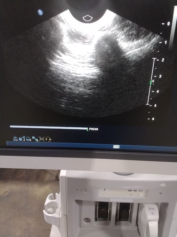 PHILIPS C8-4v Ultrasound Transducer