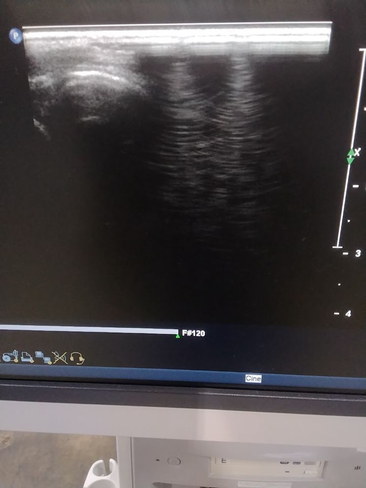 PHILIPS L12-5 Ultrasound Transducer