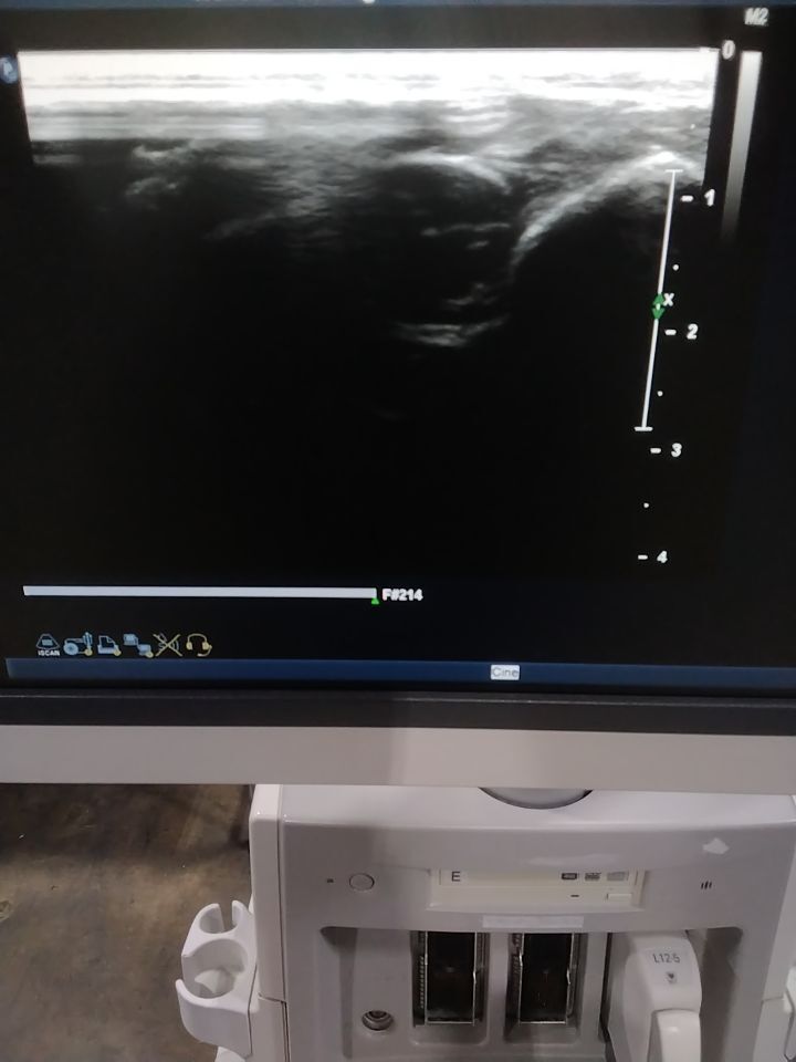 PHILIPS L12-5 Ultrasound Transducer