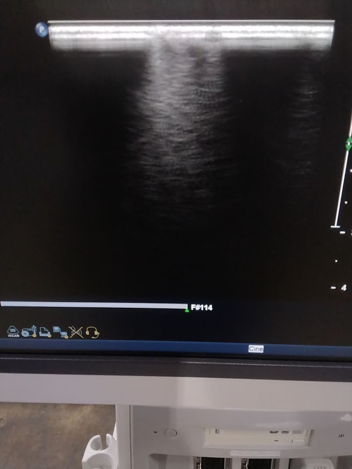 PHILIPS L17-5 Ultrasound Transducer