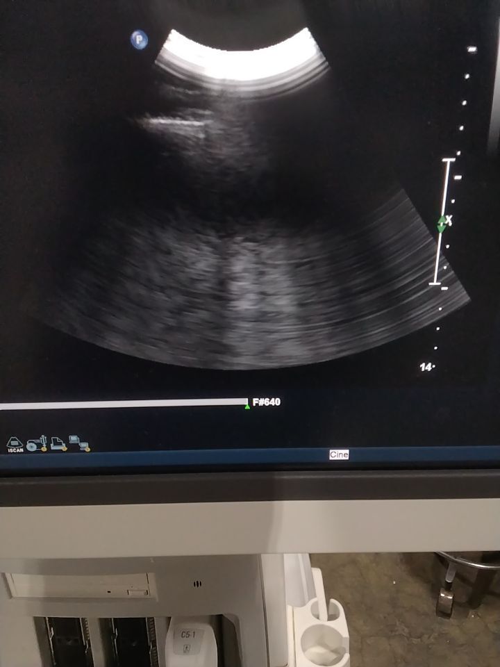 PHILIPS L5-1 Ultrasound Transducer