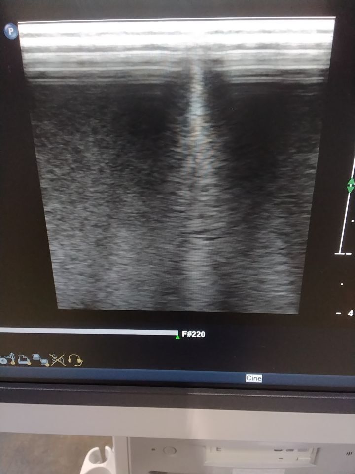 PHILIPS L9-3 Ultrasound Transducer