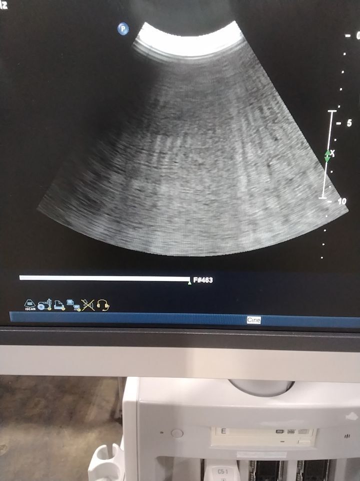 PHILIPS Purewave C5-1 Ultrasound Transducer