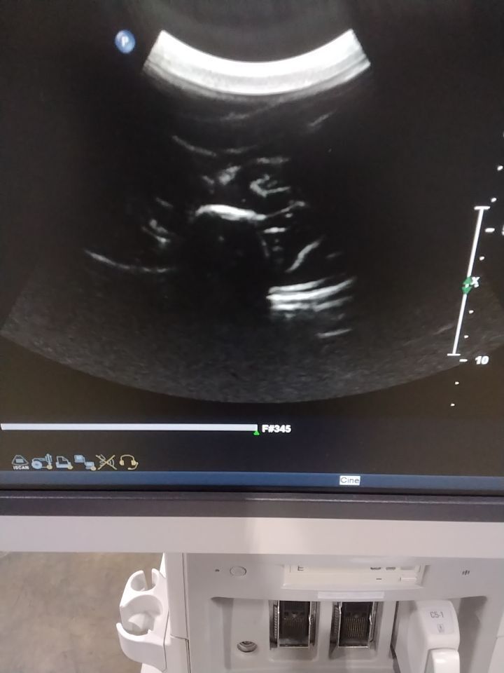 PHILIPS Purewave C5-1 Ultrasound Transducer