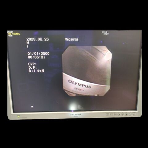 OLYMPUS BF-P160 Bronchoscope