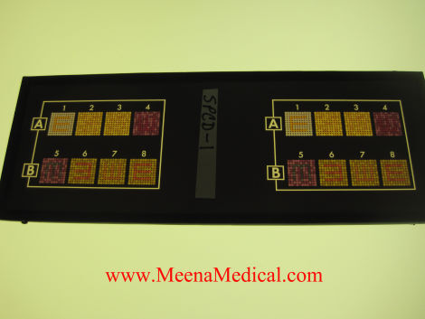 TITMUS Titmus OV-7 Vision Slides P/N: Vision Screener