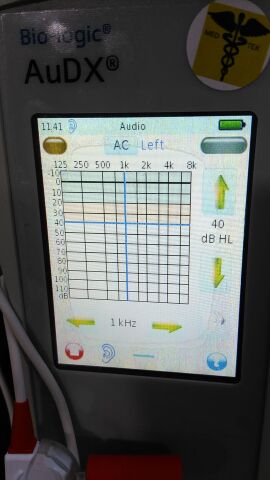OTOMETRICS Sentiero Otometrics Sentiero OAE System
