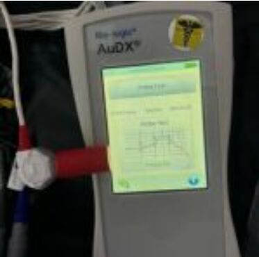 OTOMETRICS Sentiero Otometrics Sentiero OAE System