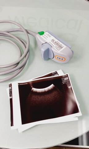 ZONARE C5-2 Ultrasound Transducer