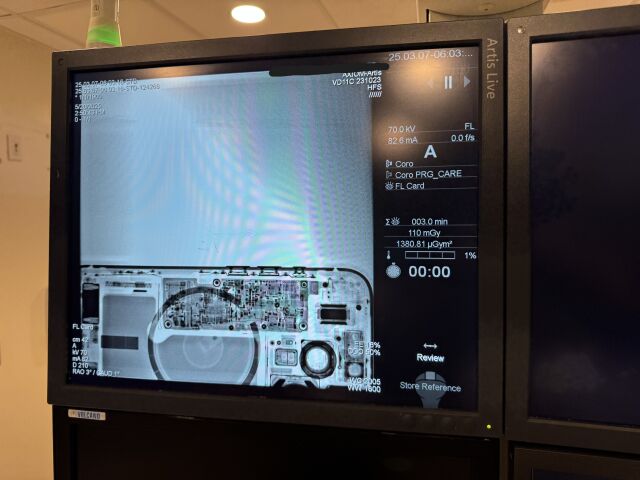 SIEMENS Artis Zee Single Plane Cath Lab