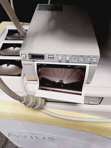 HITACHI HI VISION Avius Ultrasound System