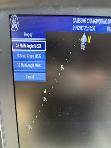 GE Vivid i with Convex 4CRS Cardiac 3SRS Two Probe Ultrasound OB / GYN