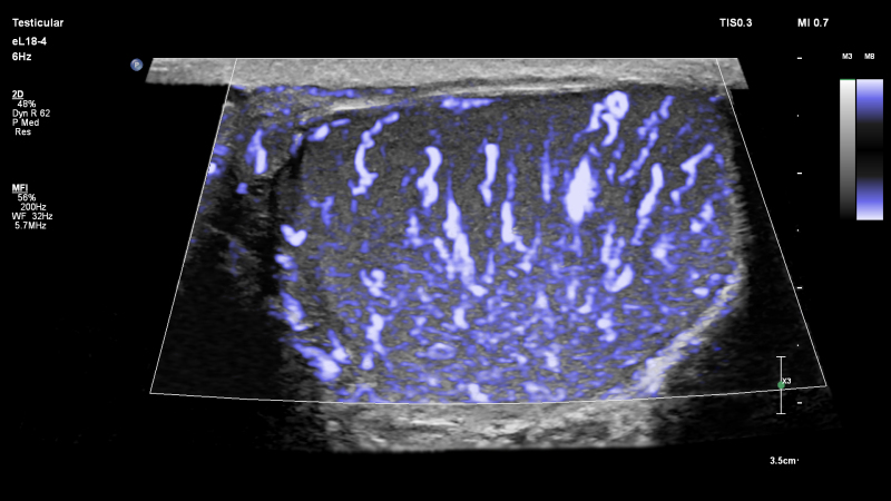 philips-scores-fda-clearance-for-small-parts-ultrasound-imaging-solution