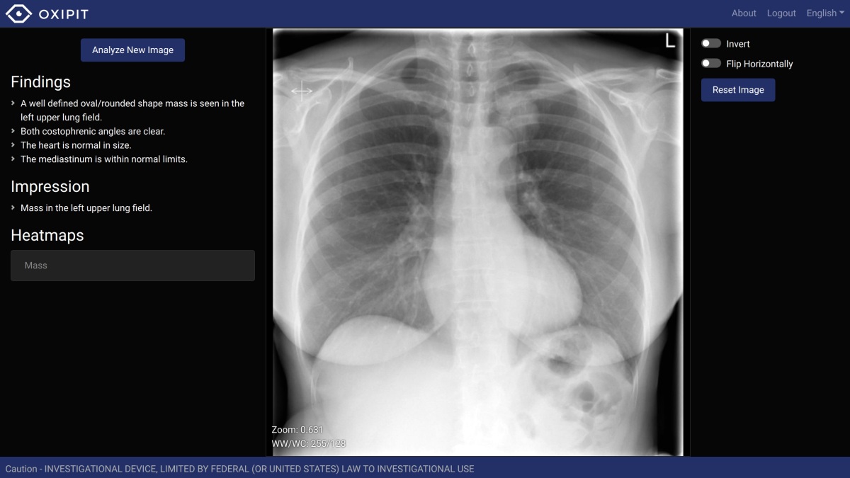 Oxipit Scores Ce Marking For Chesteye Radiology Imaging Suite