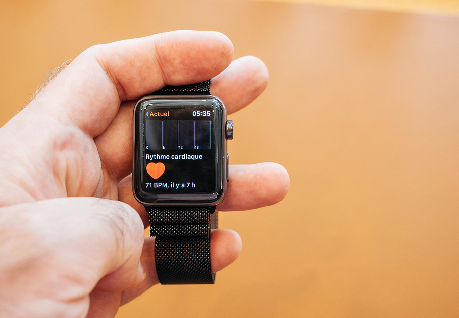 Can Apple Watch Really Detect Atrial Fibrillation