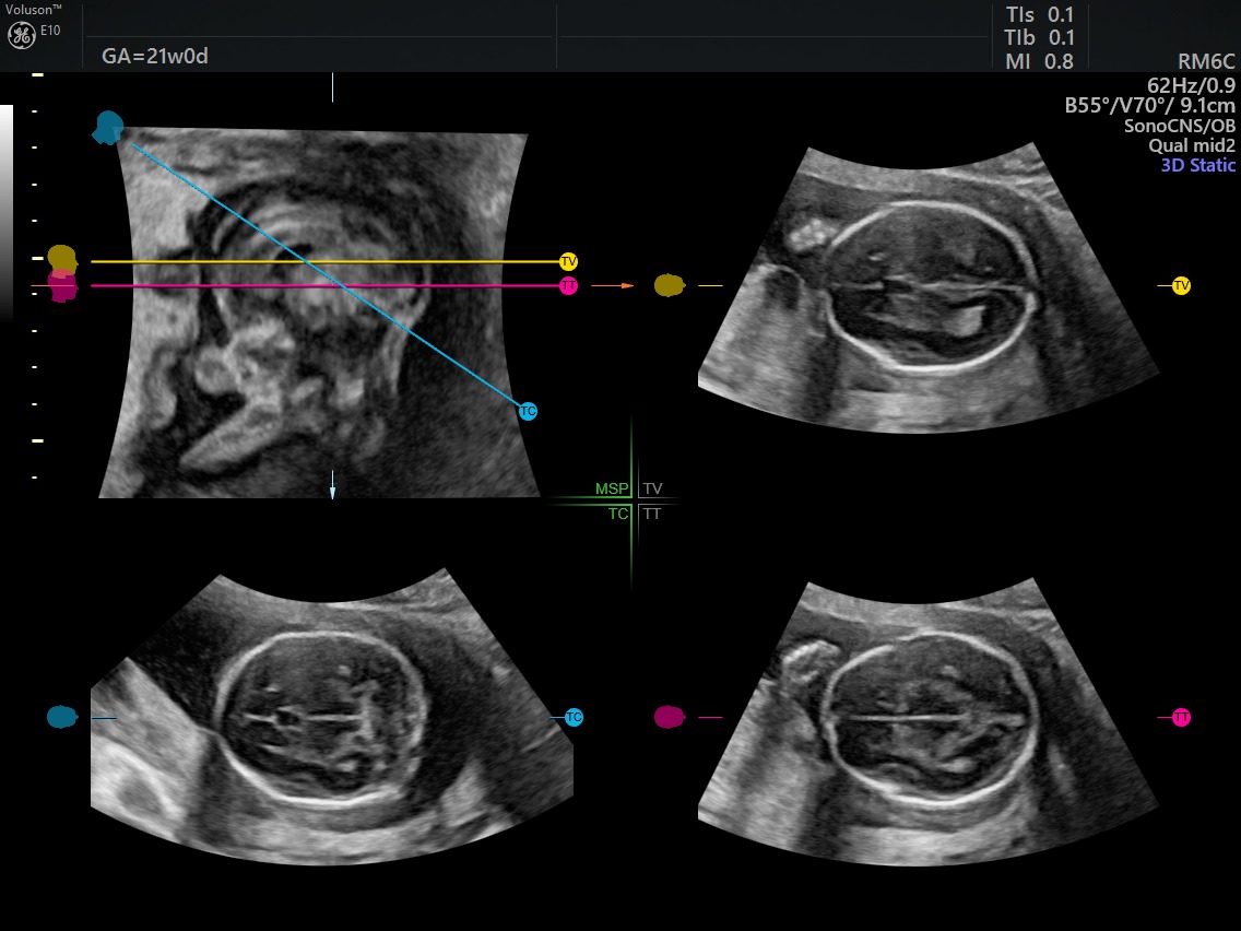 OB/GYN ultrasound: is the field ready to adopt new technology in the ...
