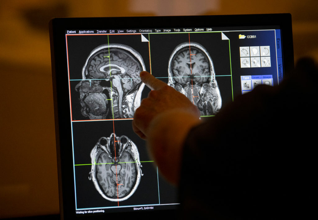 Cleveland Clinic brain study aims to spot neurological diseases before ...